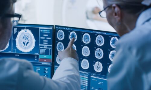Neurologia