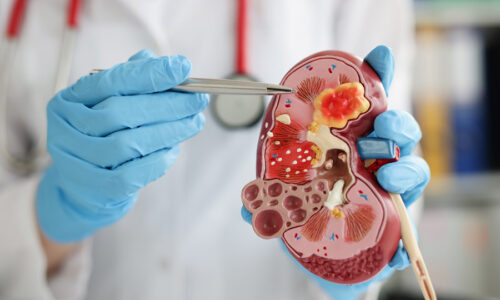 ynovapos-nefrologia-urologia